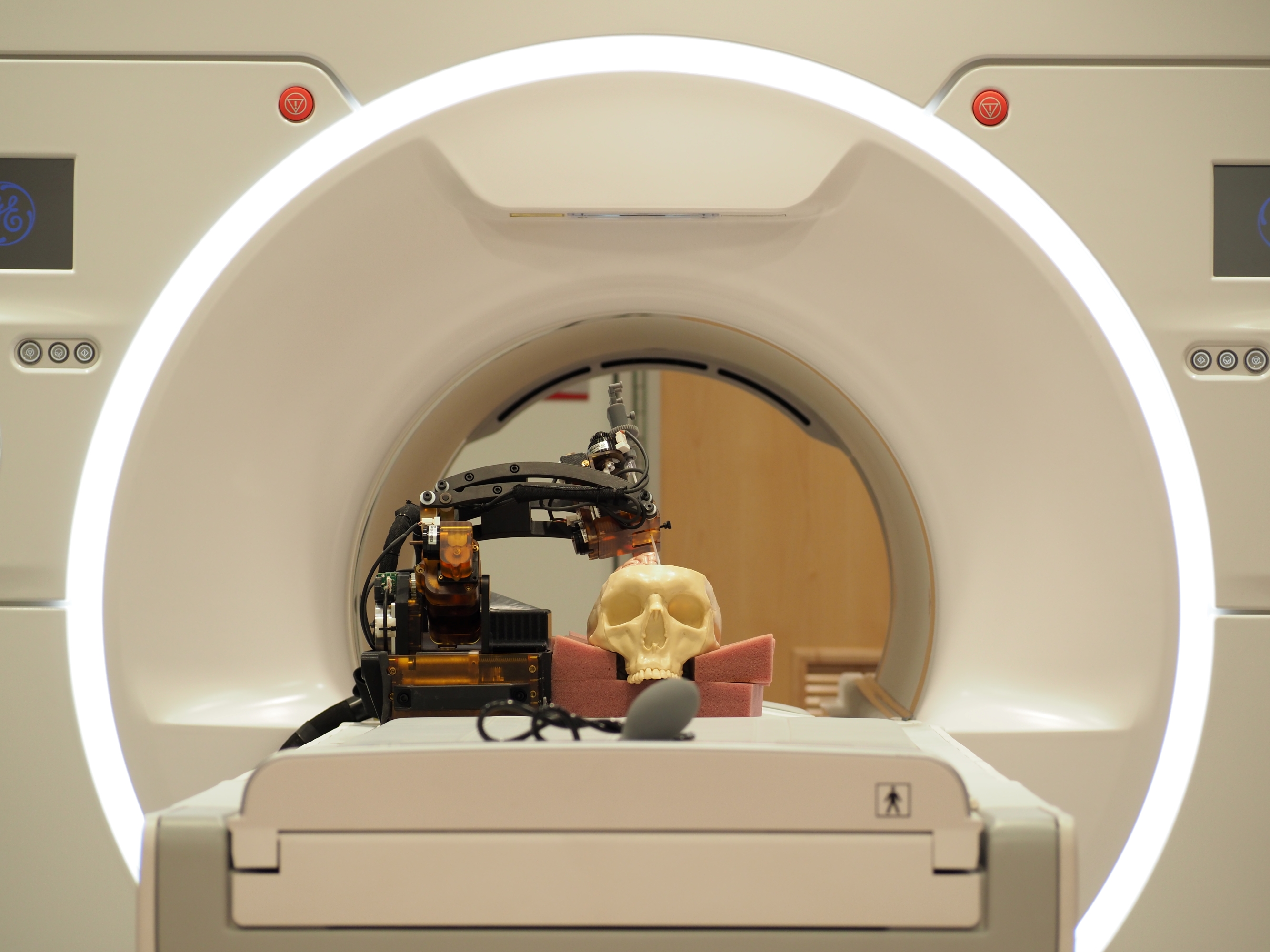 MRI with skull