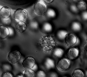 Pollen grains taken on Zeiss Aviovert 200M at 40x