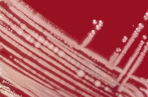  Pseudomonas aeruginosa colonies on an agar plate